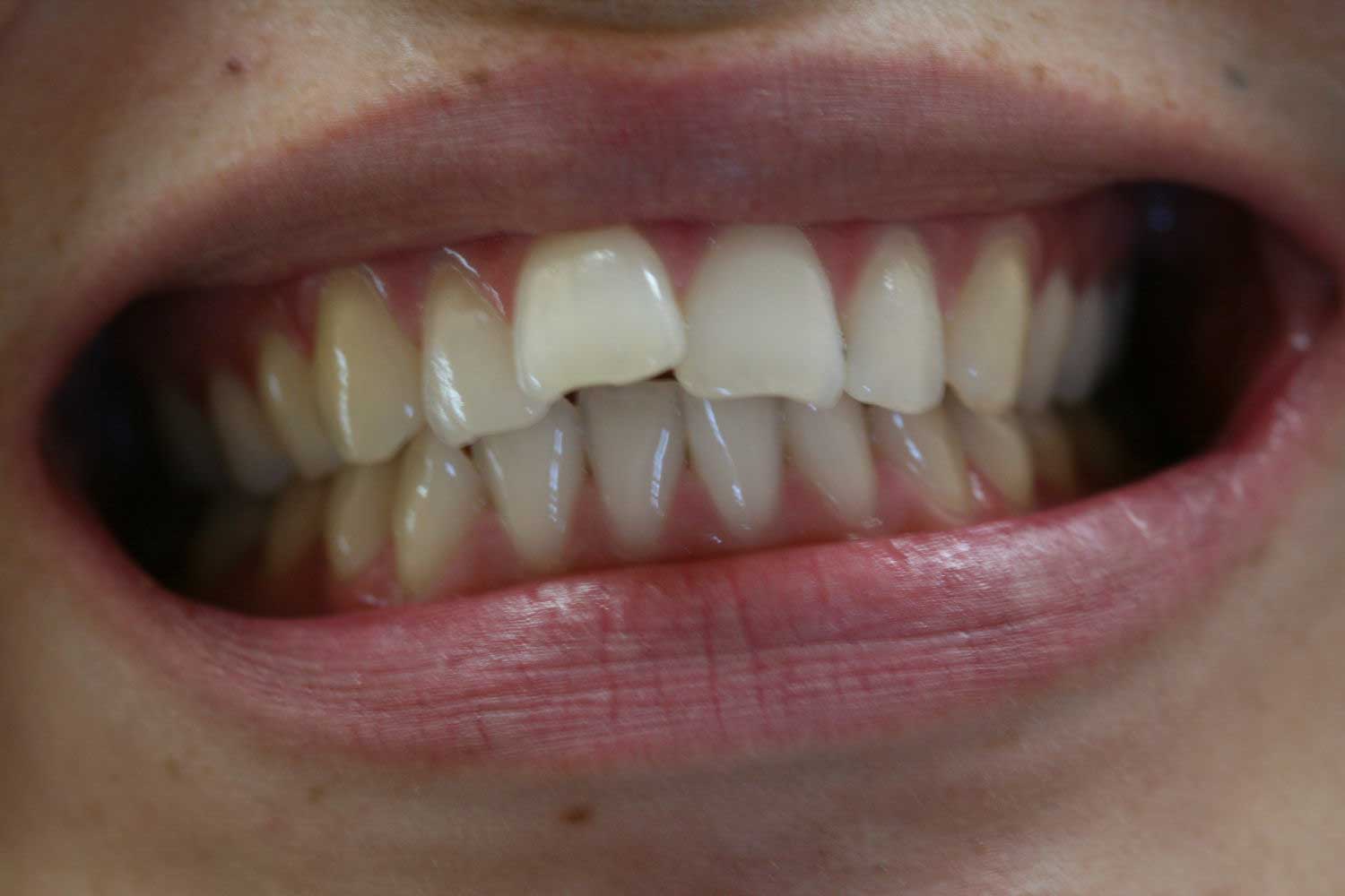 Orthodontics before 1