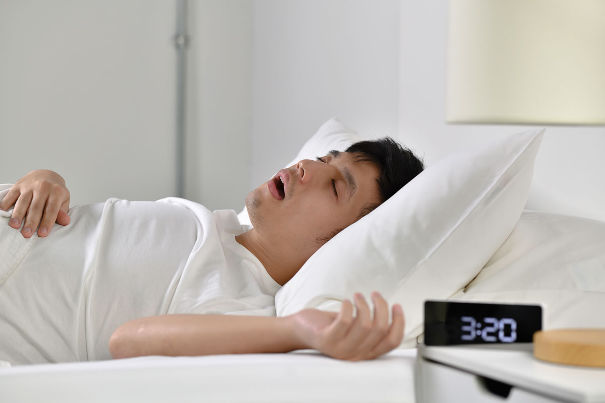 Sleep apnea treatment